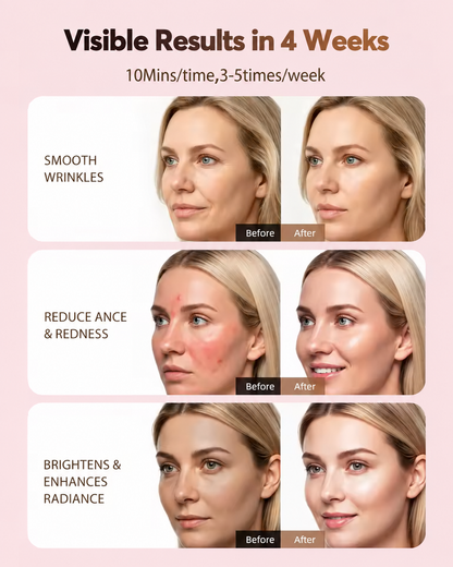Nexalure Wireless LED Face Mask